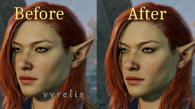 No Elf Freckle